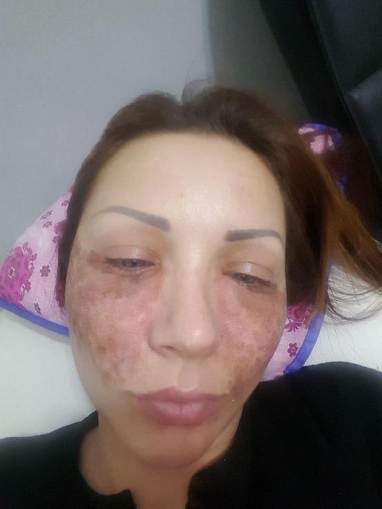 Bulgar modelin estetik kabusu; kuaför kardeşler: Örümcek ağı yapmadık, iftira