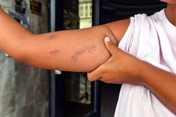 Gizemi, babasıyla arazi anlaşmazlığı yaşayan amcası darbetti