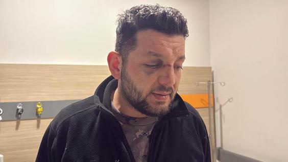 Gürültü tartışmasında komşusu tarafından, kucağındaki 14 aylık bebeğiyle darbedildi