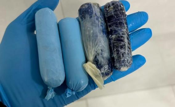 Vücudundaki 140 gram uyuşturucu radyolojik muayeneyle tespit edilen şüpheli tutuklandı