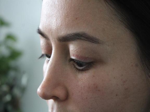 Güzellik salonundaki işlem sonrası gözünde hasar iddiasıyla yaptığı şikayet reddedildi; Uzmanına gidin uyarısı yaptı