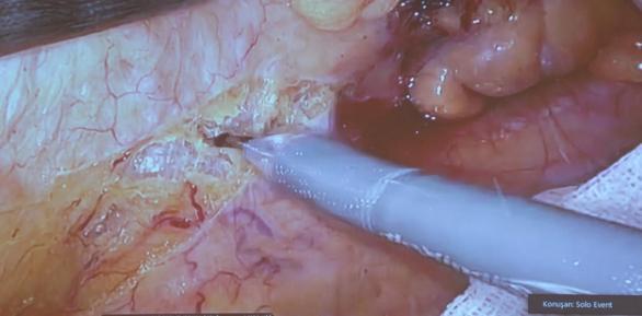 İstanbul 16’ncı Asya Pasifik Kongresi ev sahipliği yapıyor