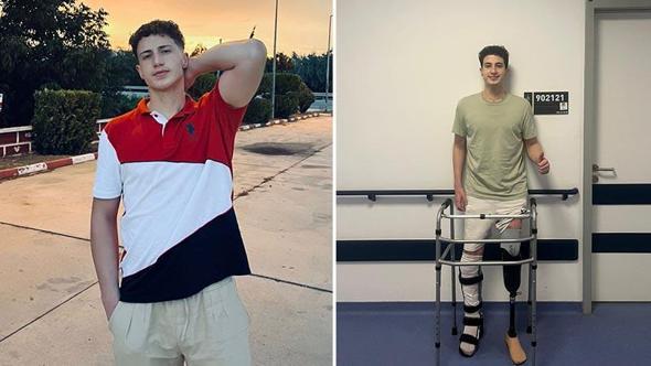 Motosiklet kazasında bacağını kaybeden Berk, protezle ayağa kalktı