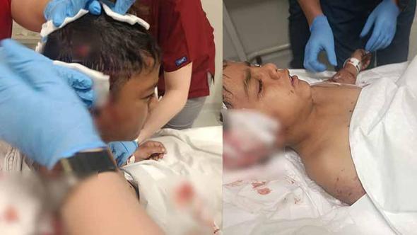 Okul çıkışı sokak köpeklerinin saldırdığı Davut, yaralandı