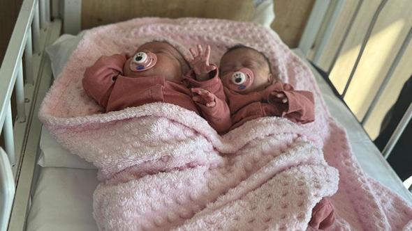 Prematüre ikizler, anjiyo ile hayata tutundu