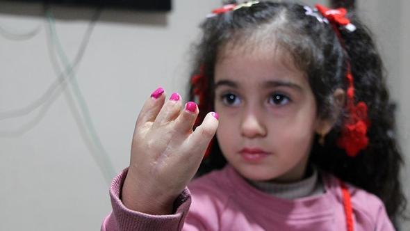 10 ameliyat geçiren yapışık parmak Elif Lina’nın ailesinden çağrı