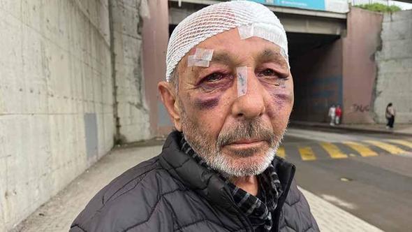 Önce çakmak istediler ardından sokak ortasında darbettiler