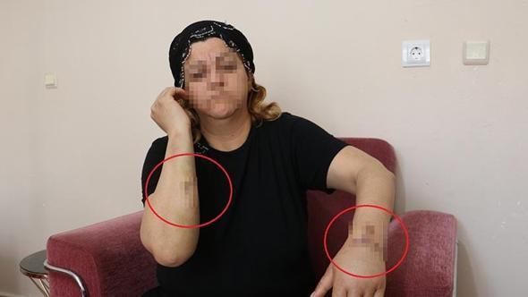 16 yıl dini nikahla birlikte yaşadığı kişi tarafından 30 yerinden bıçaklandı