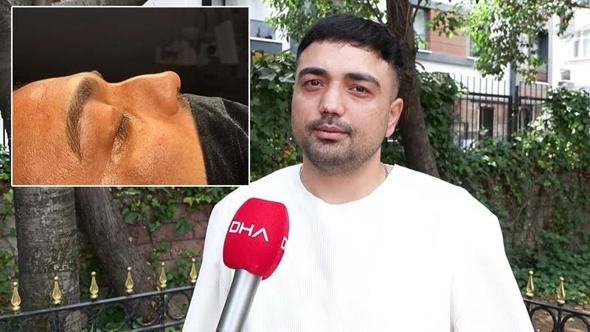 Horlama şikayetiyle 4 kez ameliyat oldu: Düzelmesi için daha kaç kere olmam gerek