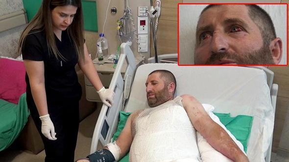 Çalışırken akıma kapılıp vücudunun 3’te 1’i yandı: Elektrik şakaya gelmiyor