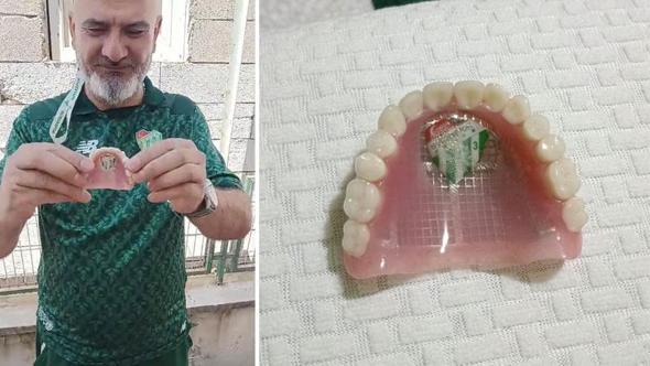 Bursaspor’un fanatik taraftarı takma dişinin damağına da kulüp amblemi yaptırdı