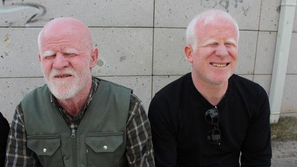 Ailesinin geçimi, babası ve kardeşi gibi kendisi de albino olan Gökhan’a emanet