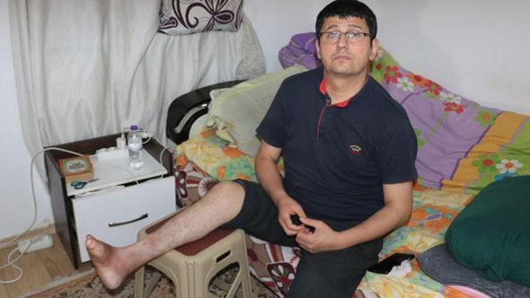 19 yıldır ayağındaki yaraya çare arıyor