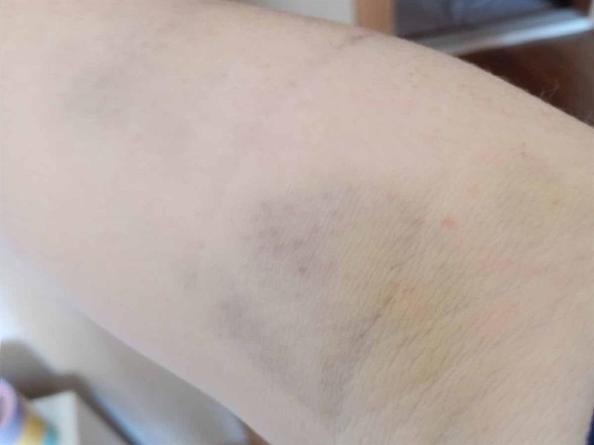 2 çocuğunu teslim etmek istediği eski eşi tarafından darbedildi; o anlar kamerada