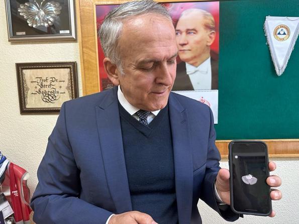 Tümör tespit eden yapay zeka algoritmasına yurt dışından talep