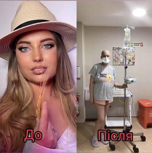 Ukraynalı Anastasia, Türk donörün iliğiyle hayata tutundu