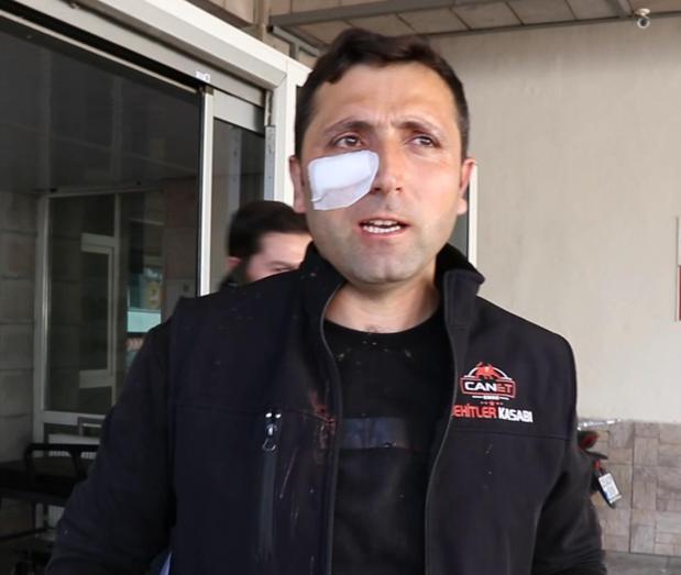 Kurban keserken kalp krizi geçirip öldü
