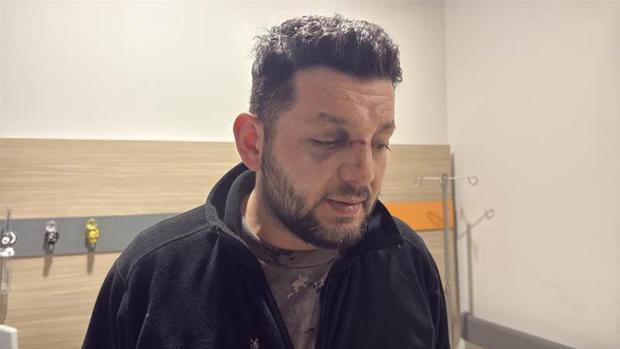 ‘Çocuk annesinin kucağından düştü, babası kendi burnundaki kanı üzerine akıttı’