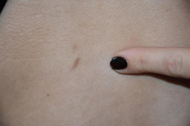 Komşusunun boynundan bıçakladığı Betül: Hala kabuslar görüyorum