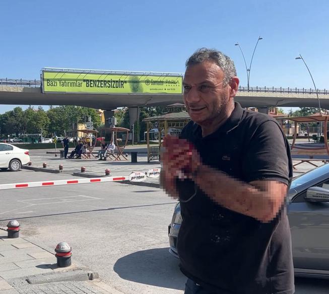 Kurban Bayramının ilk gününde acemi kasaplar hastanelere koştu
