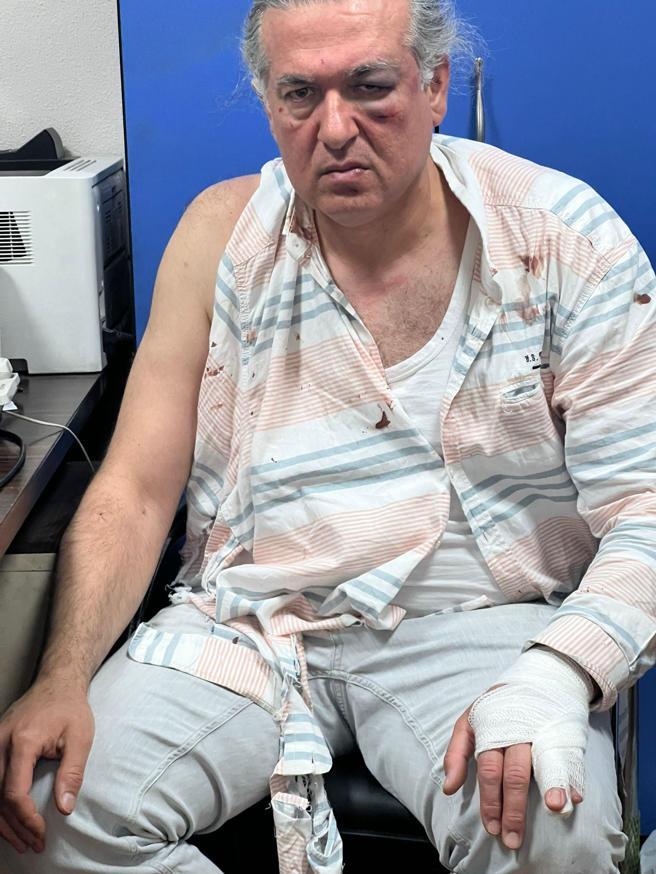 Kuzenini öldüren doktor cezaevinde intihar etti