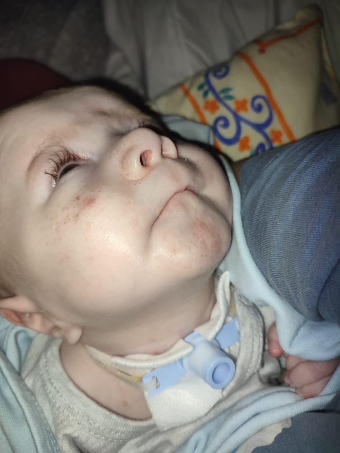 Ölümcül hastalıkla mücadele eden 7,5 aylık Poyraz kurtarılamadı