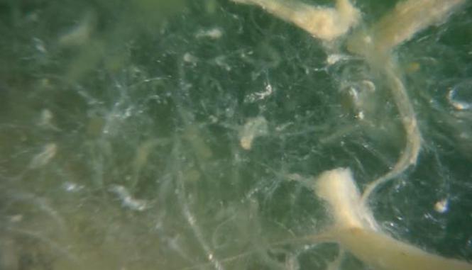 Prof. Dr. Mustafa Sarı: Şu an kremsi müsilajı görüyoruz