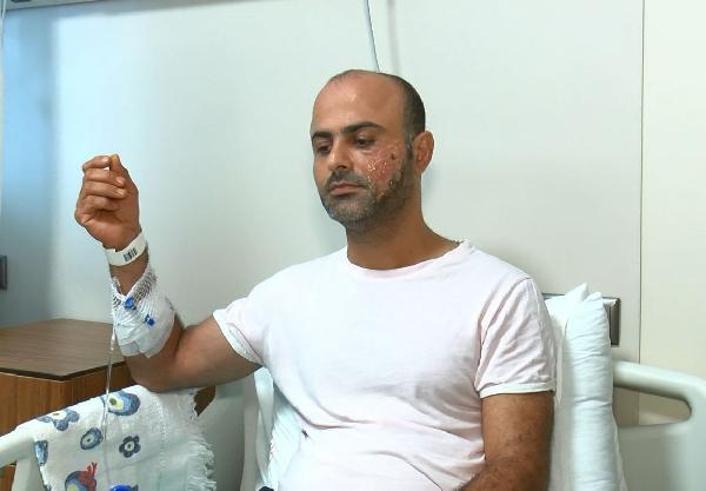 Lazer epilasyon sonrası yanık suçlaması