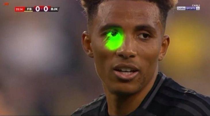 Gedson Fernandese lazer tutan taraftar gözaltına alındı