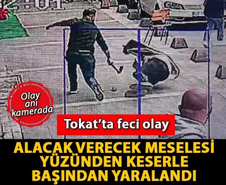 Kavgada keser darbesiyle başından yaralandı