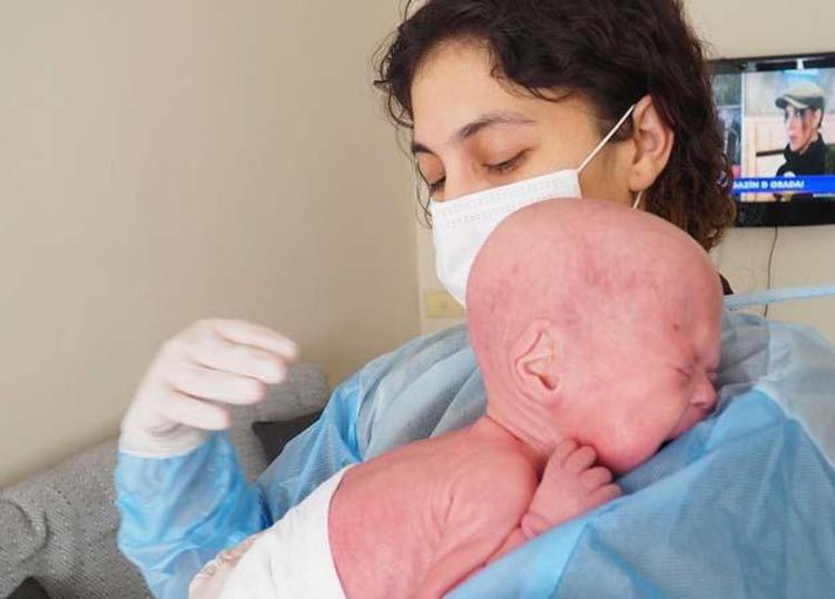 ÖLÜ DERİLERİ TEMİZLEMEK 1 SAAT SÜRÜYOR