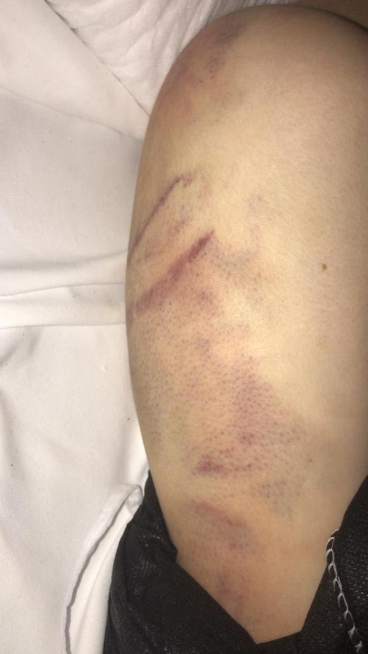 TAYT GİYDİĞİ İÇİN TARTIŞMA ÇIKARDI