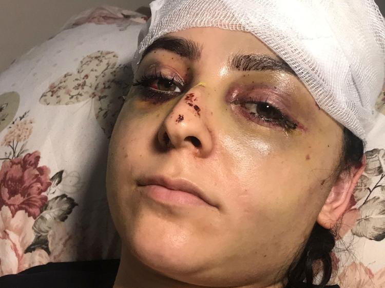 ÖLDÜRMEK İÇİN DÖVÜYOR