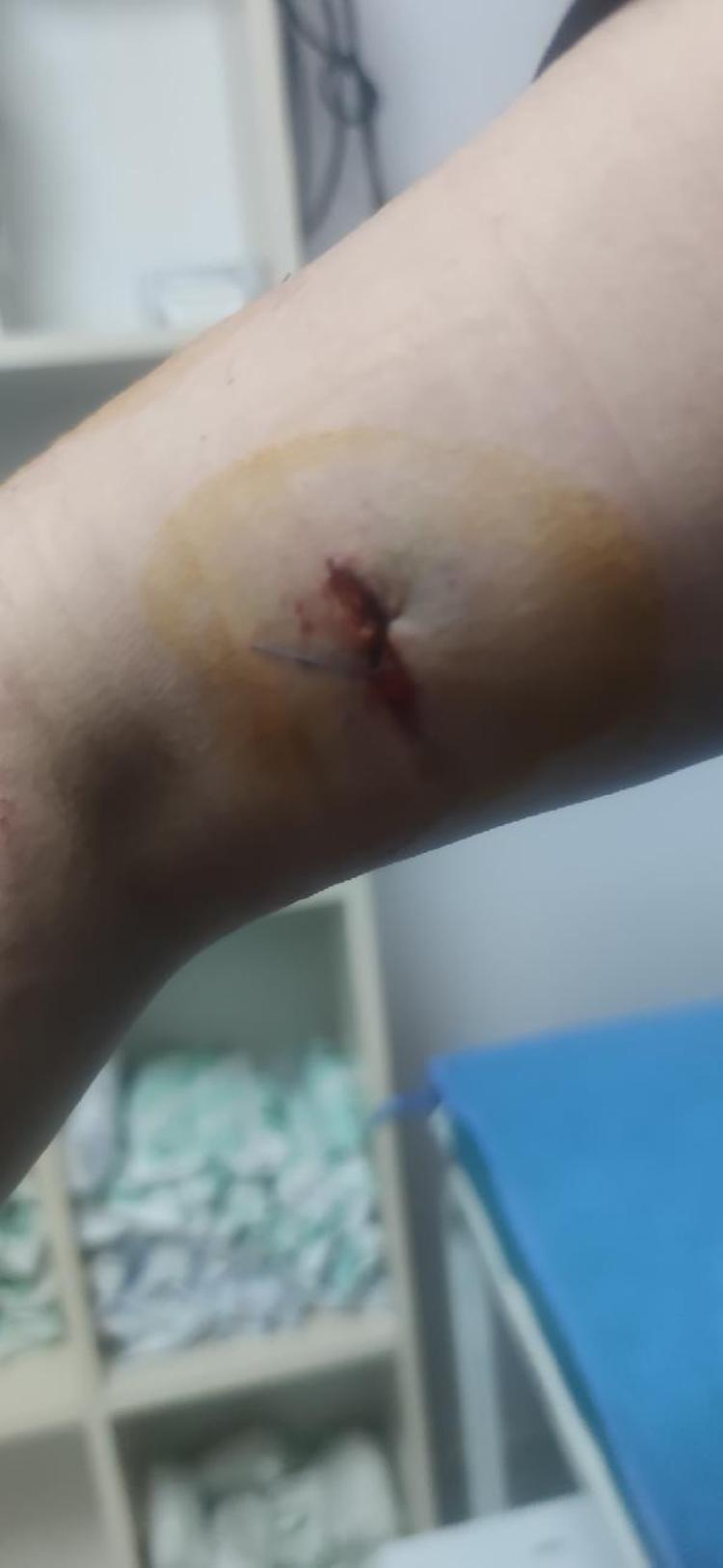 ÇOCUKLARA DA SALDIRABİLİRDİ