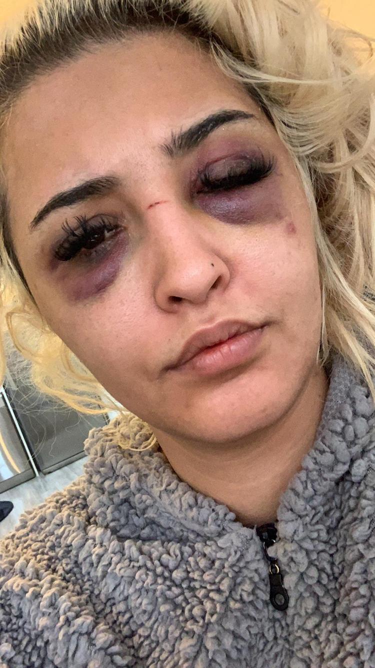 DÖVDÜKTEN SONRA, 2 SAAT UYUYALIM GİDECEĞİM DEDİ