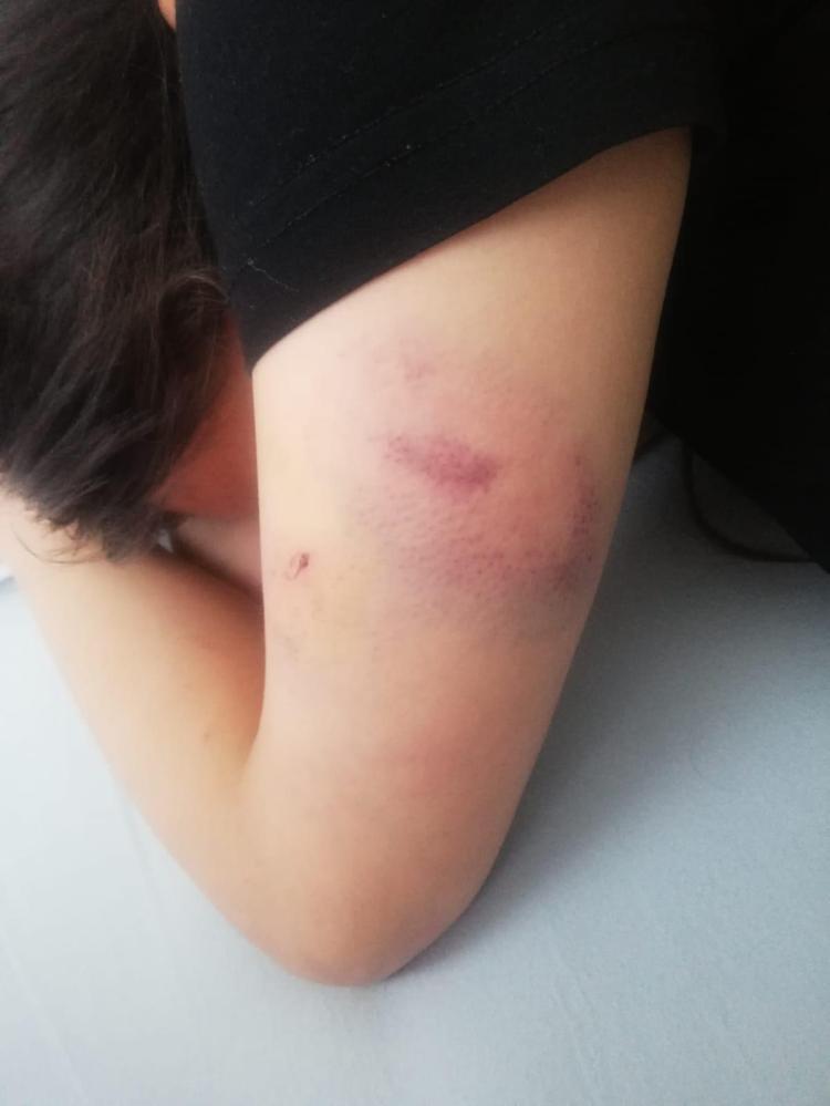 BENİM TIRNAĞIM KANADI