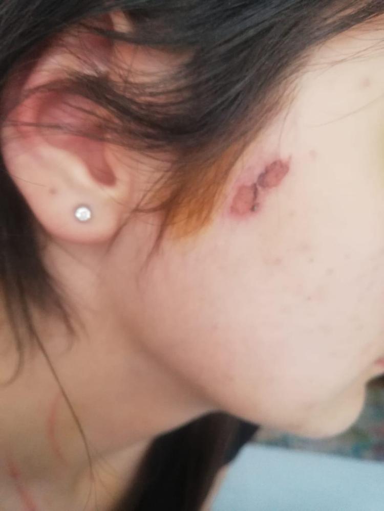 İŞKENCE RAPORLA İSPATLANMIŞ