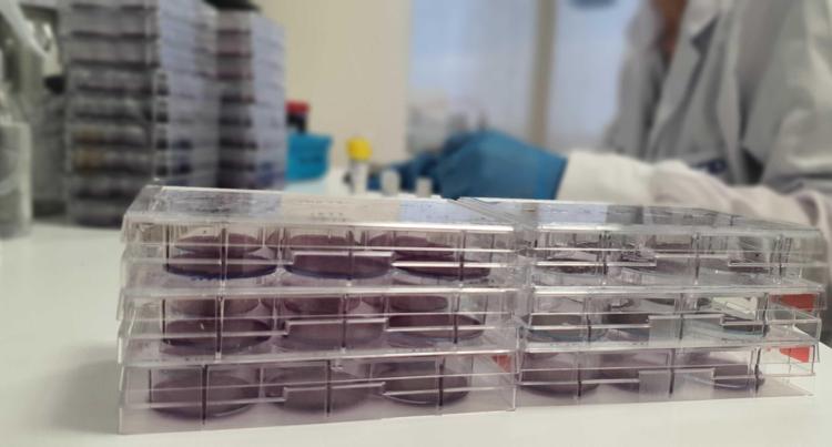 YERLİ ÜRETİM PCR İLE YAYGIN OLARAK HER YERDE TEST YAPILABİLİR