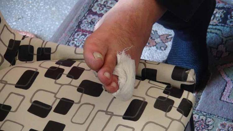 KADINI KURTARIRKEN 2 PARMAĞI KIRILMIŞ