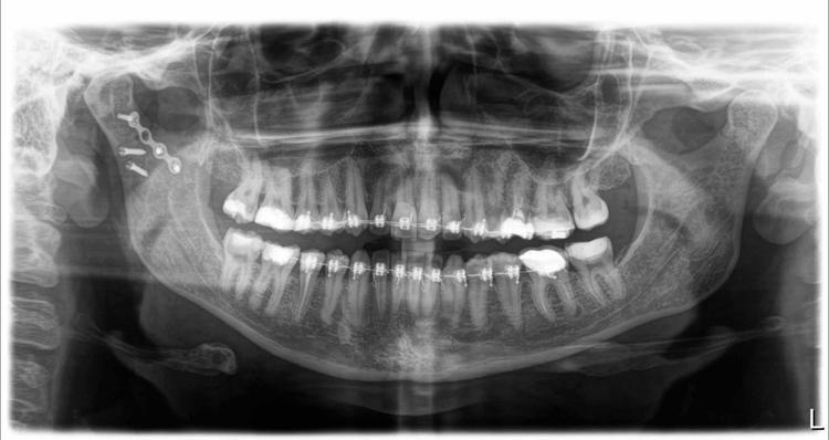 5 DAKİKALIK YOLCULUK İÇİN 7 AY TEDAVİ GÖRDÜ