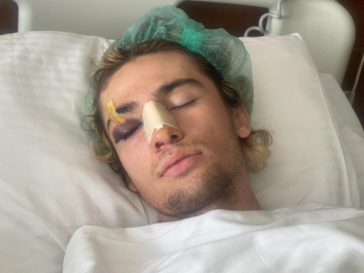 KAYKAYLA KENDİSİNE VURULUYOR