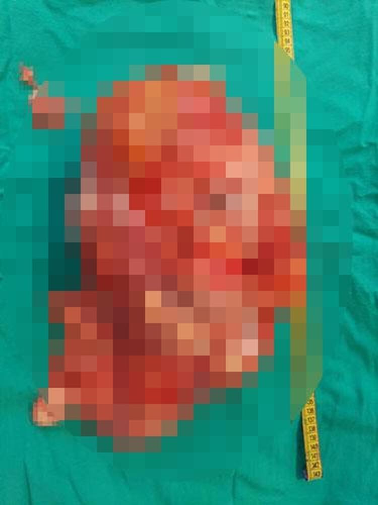 BÖYLE BİR KİTLE TAŞIDIĞIMI HİÇ FARKETMEDİM