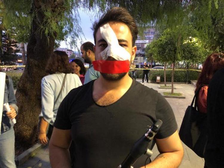 SALDIRIYA UĞRAYAN KARAGÜNDÜZ: BİZ MÜZİSYENLER DÜNYANIN SESİYİZ