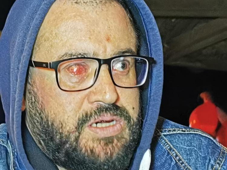 ‘KIZ ARKADAŞIM DA YUMRUK YEDİ’