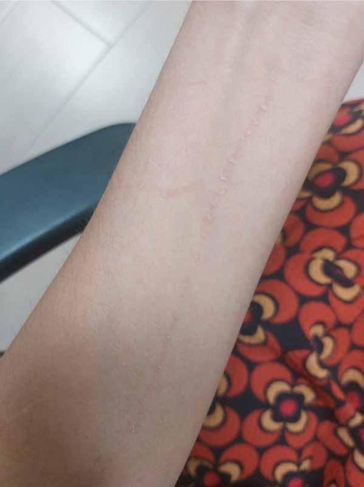 KÖPEĞE ACIDIĞIM İÇİN MESAJ GÖNDERDİM