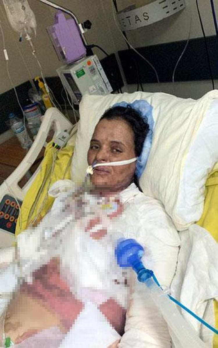 KONUŞAMIYOR, NEFES ALAMIYOR