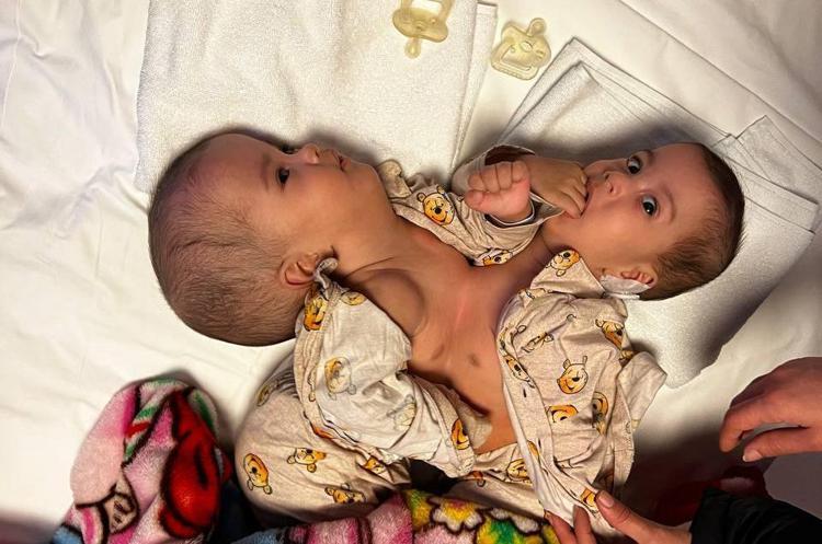 GERÇEĞİNDEN ÖNCE SANAL AMELİYAT YAPTIK