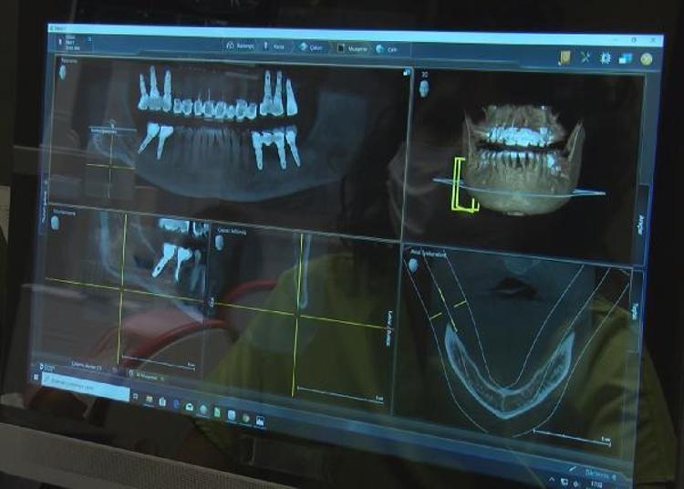 BU BİR MODA, SAĞLIKLA ALAKASI YOK