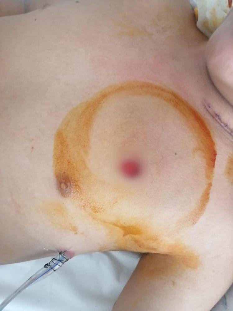 8 DEFA BANA HAMLE YAPTI