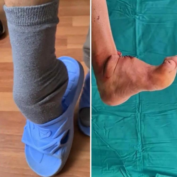 ELİNDEKİ ŞEKİL BOZUKLUĞU DA DÜZELTİLECEK